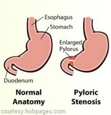 Pin On Pediatric Nursing