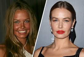 After more than 10 years in the spotlight, it's crazy to believe that lara worthington is only 29. Lara Worthington Before And After From Bingle To Beauty Icon Beauty Crew