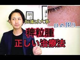 目の周りの 稗粒腫 はいりゅうしゅ に悩んでる方が知っておきたい治療法を紹介します youtube スキンケア 治療 美肌 スキンケア