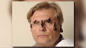 Lovable leeches? Practitioner says therapeutic benefits outweigh the 'ick' 