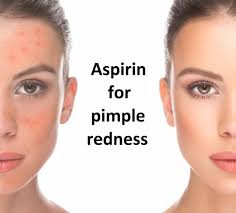 They work just as well for pimples and will help to reduce the angry redness of them. How To Use Asprin For Pimples And Redness Caused By Them