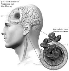 Eifersucht auf die Narren