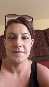 Answering questions about dementia