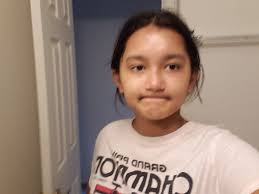 Kids' skin red and cracking from pool use?