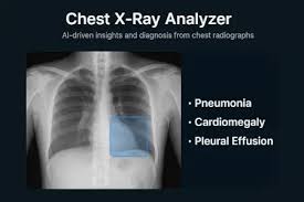 Image result for XRay Interpretation