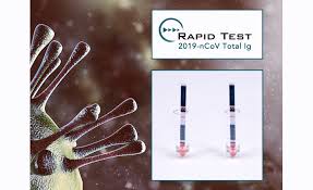 Monoclonal antibodies are a rapidly growing class of biotherapeutics whose rigorous characterization by mass spectrometry requires reproducible denaturation and digestion. Rapid Antibody Testing Against Covid 19 High Sensitivity