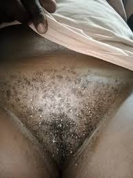 Muschi-Haare Porn Pics: Nude Women in Free Sex Photos | xHamster