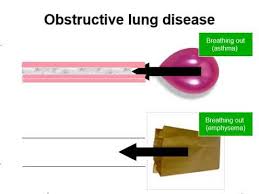 obstructive lung disease vs restrictive lung disease in less than 5 minutes