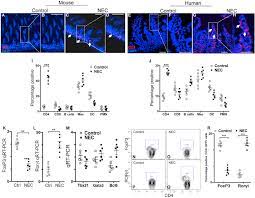 We report here a preterm patient who died because of severe diffuse necrotizing enterocolitis (nec) after topical application of 0.5% cyclopentolate and 1.25% phenylephrine during rop screening to emphasise the serious side effects of these agents. Necrotizing Enterocolitis Pathophysiology From A Historical Context Sciencedirect