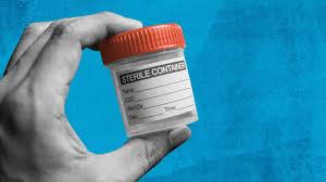 Several types of tests can be used to find a chlamydia infection, but the public health agency of canada (phac) recommends a nucleic acid. 4 Of The Best Home Chlamydia Tests