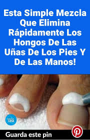 Tinea unguium, cuando afecta las uñas. Esta Simple Mezcla Que Elimina Rapidamente Los Hongos De Las Unas De Los Pies Y De Las Manos Fruit Health Benefits Health Health Tips