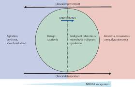 Image result for Echophenomena
