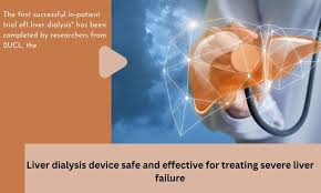 مزایای دیالیز کبد
