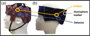 Menores preços maiores preços mais relevantes mais vendidos mais avaliados. Photogrammetry Based Stereoscopic Optode Registration Method For Functional Near Infrared Spectroscopy