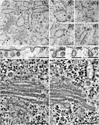 Check spelling or type a new query. Plant Golgi Ultrastructure Robinson 2020 Journal Of Microscopy Wiley Online Library