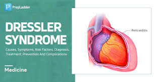 Image result for Post-MI Pericarditis