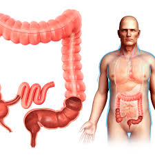 Jun 11, 2021 · colon cancer is a type of cancer that begins in the large intestine (colon). 10 Interesting Facts About Your Colon