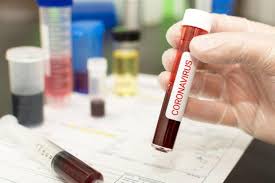 Mungu ni mwenye uwezo hakuna jambo ambalo hawezi kwa ukweli wamutumainiye mungu nikama mulima sayuni wana. Jamiiforums Coronavirus Kifo Cha Kwanza Barani Afrika Facebook