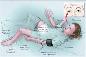 Image result for Agitated Patient