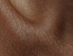 Image result for Dry Skin