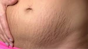 Image result for à¦«à¦¾à¦à¦¾ à¦à¦¾à¦®à§à¦¾ à¦¬à¦¾ à¦¸à§à¦à§à¦°à§à¦ à¦®à¦¾à¦°à§à¦à§à¦° à¦¸à¦®à¦¸à§à¦¯à¦¾à§ à¦à¦¨à§à¦à§à¦ à¦­à§à¦à§ à¦¥à¦¾à¦à§à¦¨à¥¤ à¦à¦®à¦¾à¦¦à§à¦° à¦¶à¦°à§à¦°à§à¦° à¦¤à§à¦¬à¦à§ à¦¬à¦¿à¦­à¦¿à¦¨à§à¦¨ à¦à¦à¦¶à§ à¦à¦ à¦«à¦¾à¦à¦¾ à¦¦à¦¾à¦à¦à§à¦²à§ à¦¦à§à¦à¦¾ à¦¯à¦¾à§à¥¤ à¦®à§à¦²à¦¤ à¦à¦ à¦¸à¦®à¦¸à§à¦¯à¦¾ à¦¬à¦¾à§à¦¤à¦¿ à¦à¦à¦¨à§à¦° à¦à¦¨à§à¦¯ à¦¹à§à¥¤ à¦¸à¦¾à¦¥à§ à¦à¦°à§à¦­ à¦§à¦¾à¦°à¦£à§à¦° à¦®à¦¤ à¦¶à¦¾à¦°à§à¦°à¦¿à¦ à¦§à¦à¦² à¦à¦¬à¦ à¦¶à¦°à§à¦°à§ à¦ªà¦¾à¦¨à¦¿ à¦à¦¾à¦à¦¤à¦¿à¦° à¦à¦¾à¦°à¦£à§à¦ à¦¹à¦¤à§ à¦ªà¦¾à¦°à§ à¦ à¦§à¦°à¦¨à§à¦° à¦¸à¦®à¦¸à§à¦¯à¦¾à¥¤ à¦¤à§à¦¬à¦à§à¦° à¦à¦ à¦«à¦¾à¦à¦¾ à¦¦à¦¾à¦ à¦¦à§à¦°à§à¦à¦°à¦£ à¦¯à§à¦¨ à¦à¦ à¦à¦¸à¦®à§à¦­à¦¬ à¦à¦¾à¦à¥¤ à¦à¦¿à¦¨à§à¦¤à§ à¦¨à¦¾, à¦à¦à¦¨ à¦à¦° à¦à¦¸à¦®à§à¦­à¦¬ à¦¨à§à¥¤ à¦¬à¦°à¦ à¦à§à¦¬ à¦¸à¦®à§à¦­à¦¬à¥¤ à¦à§à¦­à¦¾à¦¬à§ à¦à¦¾à¦¨à¦¤à§ à¦à¦¾à¦¨?