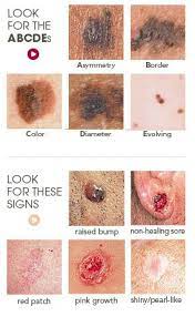 Pin On Health