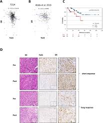Prostate cancer occurs when abnormal prostate cells develop and grow in an uncontrolled way, often multiplying and spreading. Tle3 Loss Confers Ar Inhibitor Resistance By Facilitating Gr Mediated Human Prostate Cancer Cell Growth Elife
