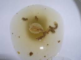 Maybe you would like to learn more about one of these? What Is A Normal Bowel Movement Natural Health Techniques