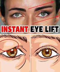 How To Treat Droopy Eyelids Naturally… The Results Are Amazing!