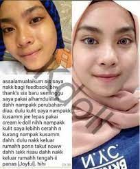 Pengguna k doll beauty skincare, asyalliee. K Doll Beauty Skincare Skin Care Beauty Skin Care Beauty