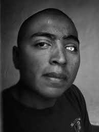 For Wounded Marines, The Long, Hard Road Of Rehab