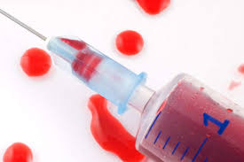 A prospective study in spain ho g. Detecter Les Cancers De La Gorge 12 Ans Avant Par Une Prise De Sang