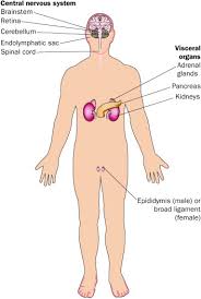 Von Hippel Lindau Disease The Lancet