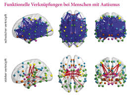 Wie Autismus Sich Im Laufe Des Lebens Verandert Spektrum Der Wissenschaft