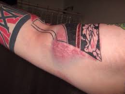 6 Steps How To Treat An Infected Tattoo Take In Consideration Infected Tattoo Healing Tattoo Tattoos