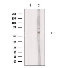 Sensitivity and specificity of prepared conjugated secondary antibodies were detected using positive and negative camel serum samples reacted stored for 1 year at −20°c. Pah Antibody Mybiosource