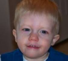 Faces Of 22q 22q Family Foundation