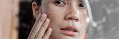 Shea Butter: the secret to good skin and hair