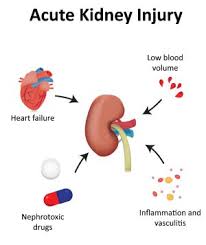 Acute renal failure occurs when renal function suddenly declines to very low levels, so that little or no urine is formed, and the substances, including even water, that the kidney normally eliminates are. Acute Kidney Injury Versus Chronic Kidney Disease Nursingcenter