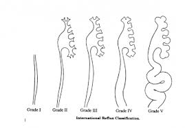 Pin On Kidney Disease