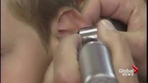 Never push the q tip fully into your ear as it can damage your ear and cause hearing loss. Want To Clean Your Ears Put Down The Q Tips Doctors Reminding Us National Globalnews Ca