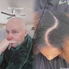 The death of Deborah hits home so hard to so many of us who are battling  this disease. And I am so sorry that her six children and husband have to  live the rest of their lives without her and I pray t ...