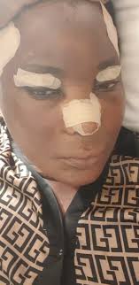 Has anyone used Dr. Burns in Dallas Texas?