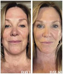 Kathy Covers Experiance With Collagen Elixir