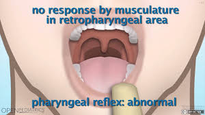 Image result for Gag Reflex