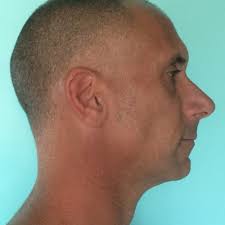 birdcontrol #pestcontrol #facilitymanagement