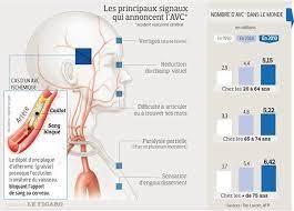 Vu que c'est le cerveau qui est privé d'oxygène pendant le malaise, il est important de vite alerter les secours. Avc Les Symptomes Qui Doivent Faire Appeler Le 15
