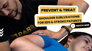 Image result for Shoulder Subluxation