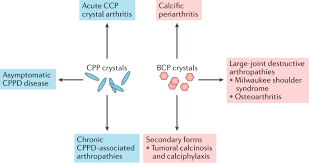 Definisi bitcoin yang wajib diketahui sebelum memilikinya. Calcium Crystal Deposition Diseases Beyond Gout Nature Reviews Rheumatology