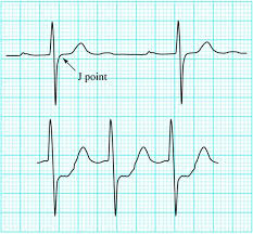 Image result for J Point